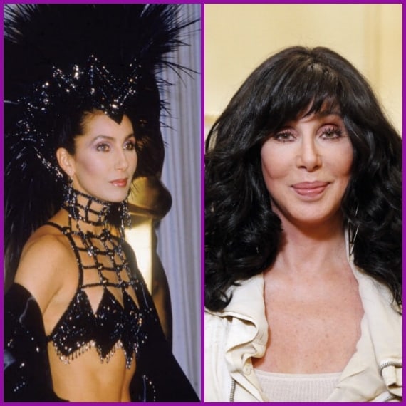 I suoi zigomi sono eccessivamente pronunciati e decisamente sproporzionati.