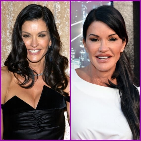 Il suo sorriso smagliante infatti è ora tirato e innaturale