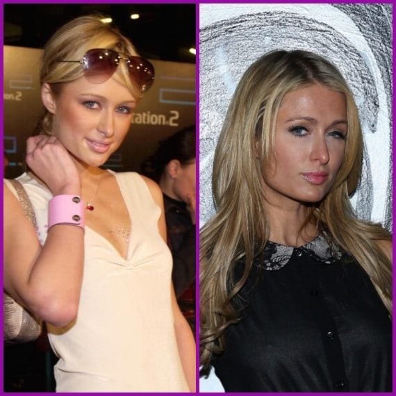 L'occhio sinistro si fa notare: con gli anni è diventato sempre più piccolo e totalmente asimmetrico.