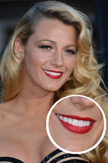 Labbro superiore più sottile