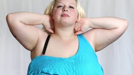 Vuole ridursi il seno perché insopportabile, ecco la risposta della Sanità Pubblica