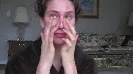 La ragazza con l'acne che grazie al trucco (e al web) diventa una modella