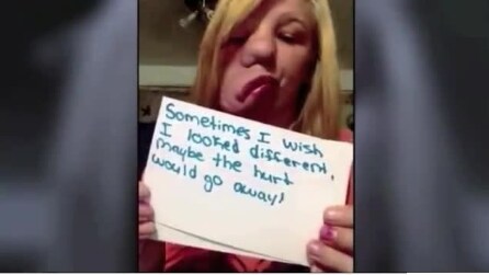 La ragazza con il volto sfigurato che si ribella ai bulli