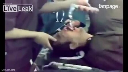 Você vai ficar chocado, os médicos removem algo terrível de seu estômago!