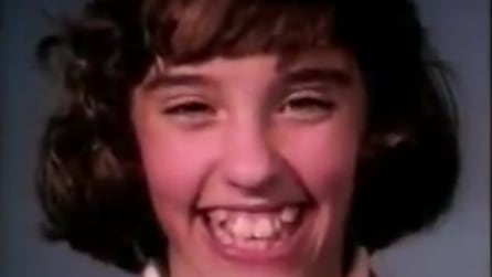 Ecco come l'apparecchio può in 18 mesi correggere il sorriso di una ragazza