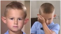 Lo prendono in giro per le sue orecchie a sventola: i genitori decidono di farlo operare
