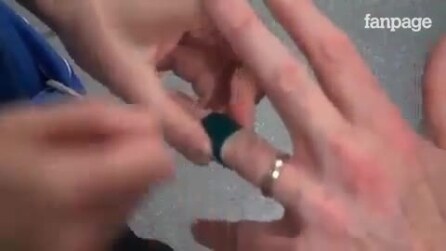 Você tem um anel entalado no dedo? O método para se livrar é absolutamente genial