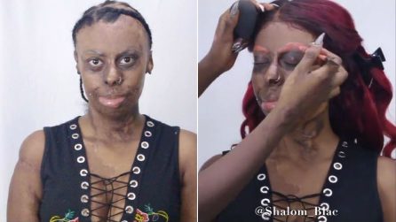 Porta sul corpo i segni di un terribile incendio: la truccatrice la rende stupenda