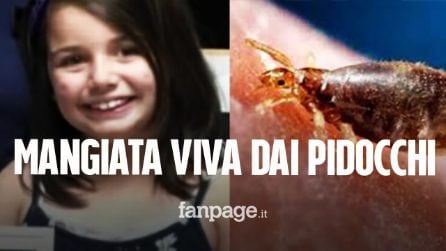 Mangiata viva dai pidocchi, Kaitlyn muore a 12 anni: grave anemia causata dai morsi degli animali