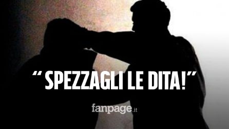 Padre di un chirurgo omosessuale paga per far spezzare le mani al figlio: "Roviniamogli la vita"