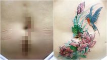 A Pele da Flor, regala tatuaggi alle donne per cancellare i segni della violenza