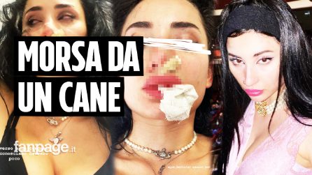 Greta Menchi aggredita al volto da un cane: “Denti come bisturi, mi hanno ricucito per un’ora