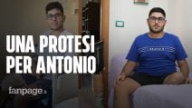 Ha un tumore raro e aggressivo e perde una gamba. Antonio sogna una protesi, ma costa 65 mila euro