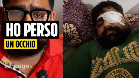 "Ferito come Satnam mentre lavoravo nei campi, non mi hanno soccorso ed ho quasi perso un occhio"