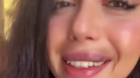 Jenny Guardiano di Temptation Island rimuove il filler alle labbra, in un video l’effetto ottenuto