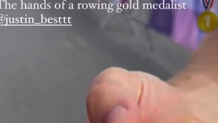 Il canottiere mostra le condizioni delle sue mani alle Olimpiadi: sono impressionanti
