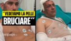 Esplosione Roma, due agenti di polizia feriti: "Vedevamo la nostra pelle bruciare, ma lo rifaremmo"