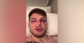 Marvin Vettori dopo la sconfitta con Allen: "Mi ha spaccato il naso subito ho combattuto così per 3 round"