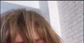 Loredana Cannata dimessa dall'ospedale dopo l'incidente all'Isola dei famosi 2025